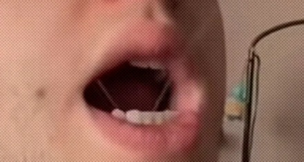 为什么有人打哈欠的时候，舌头下面会滋出小水珠？