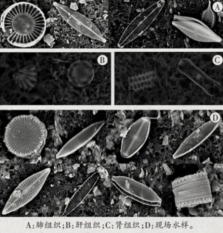 为什么法医要凭借水藻来判断是溺水还是谋杀？