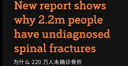 为啥英国人冬天断脚的特别多,夏天断手的特别多?