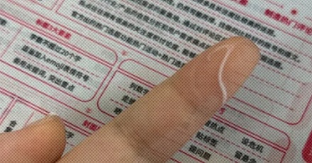 为什么有的人的嘴角总会有条白白黏黏的分泌物？