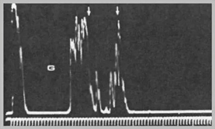 既然有「B 超」，那有「A 超」和「C 超」吗？