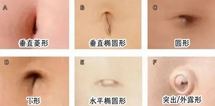 为什么全国的护士都统一把肚脐系成一坨，系成蝴蝶结会怎么样？