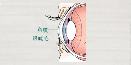 为什么眼上得了这种病，医生会建议你割个双眼皮？