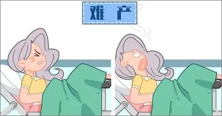 女人生孩子难产可能的原因是什么？